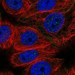 CABLES2 Polyclonal Antibody