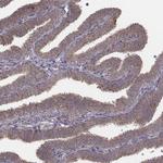PDCD2L Antibody in Immunohistochemistry (IHC)