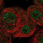 CHD8 Antibody in Immunocytochemistry (ICC/IF)