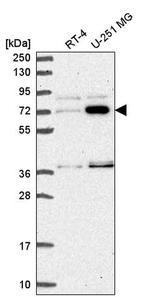 ZNF800 Antibody in Western Blot (WB)