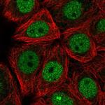 C9orf156 Polyclonal Antibody