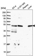 TRK fused gene Antibody in Western Blot (WB)