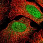 MIOS Polyclonal Antibody