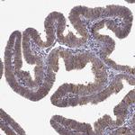 MANBAL Antibody in Immunohistochemistry (IHC)