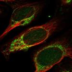 MANBAL Polyclonal Antibody