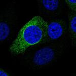 PRR11 Polyclonal Antibody