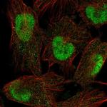 SPAG7 Polyclonal Antibody