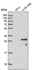 SPAG7 Antibody in Western Blot (WB)