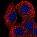 RNF135 Polyclonal Antibody