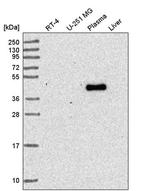 RNF135 Antibody in Western Blot (WB)