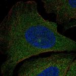 PIK3R5 Antibody in Immunocytochemistry (ICC/IF)