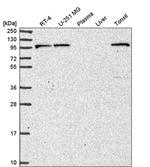 PIK3R5 Antibody in Western Blot (WB)