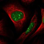 VPRBP Polyclonal Antibody