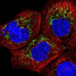 CHCHD2 Polyclonal Antibody