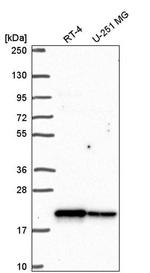 CHCHD2 Antibody in Western Blot (WB)
