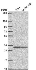 TMEM81 Antibody in Western Blot (WB)