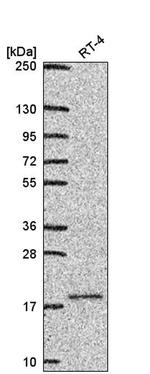 UBE2V1 Antibody in Western Blot (WB)