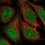 MAGEA11 Polyclonal Antibody