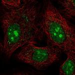 PCDHAC1 Polyclonal Antibody