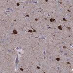 PCP4L1 Antibody in Immunohistochemistry (IHC)