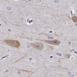 PCP4L1 Antibody in Immunohistochemistry (IHC)