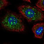 CEACAM19 Polyclonal Antibody