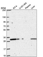 CCDC69 Antibody in Western Blot (WB)