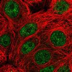 PARG Polyclonal Antibody