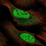 RBM12B Polyclonal Antibody