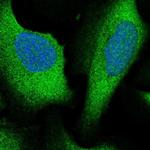 ARHGAP27 Polyclonal Antibody