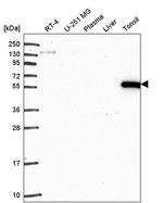 ARHGAP27 Antibody in Western Blot (WB)