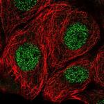 MSRA Polyclonal Antibody