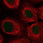 SNAPC3 Polyclonal Antibody