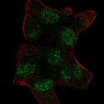 UBE2V1 Polyclonal Antibody