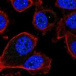 FBXL3 Polyclonal Antibody