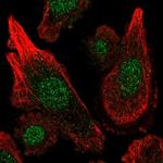 MGST3 Polyclonal Antibody