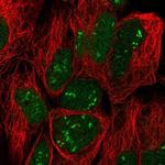 TRO Polyclonal Antibody