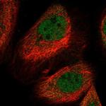 LYST Antibody in Immunocytochemistry (ICC/IF)