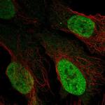 LAF4 Polyclonal Antibody