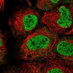 TMEM98 Polyclonal Antibody