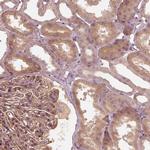 OTOGL Polyclonal Antibody