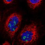 TRIM27 Polyclonal Antibody