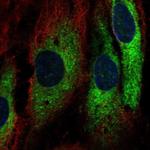 GIMAP1 Polyclonal Antibody