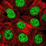 THAP4 Polyclonal Antibody