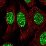 ZNF786 Polyclonal Antibody