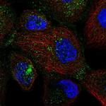 SEC24D Polyclonal Antibody