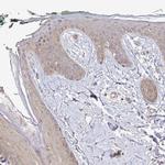 ARHGEF37 Antibody in Immunohistochemistry (IHC)