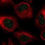 CENPB Polyclonal Antibody