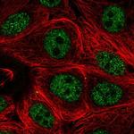 PCNX Polyclonal Antibody