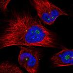 CLHC1 Polyclonal Antibody